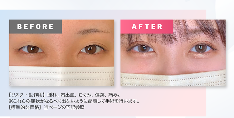 ビフォーアフターー