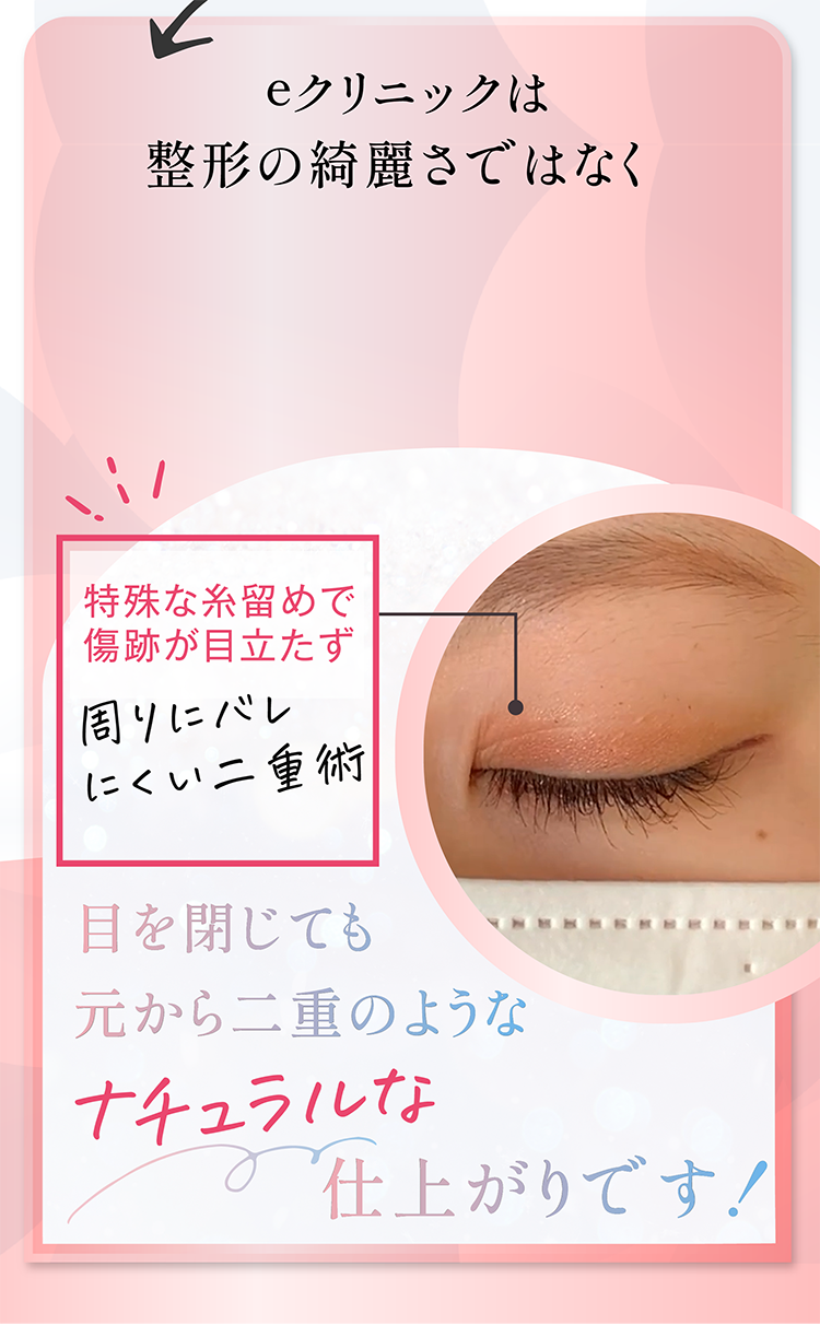 二重の幅もデザインもお選びいただけます