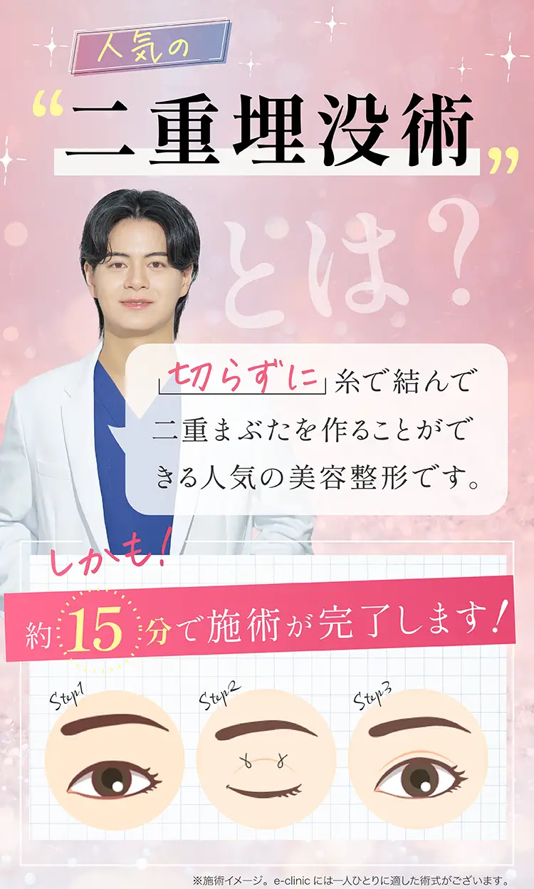 二重埋没術とは？